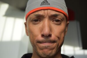 ダウンタイムを考慮した圧迫ガーメントのサイズ選び方は？